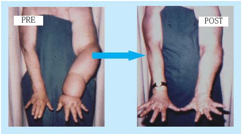 Figure 5 Figure 5