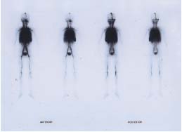 Figure C. Figure C.