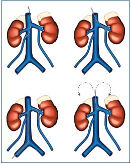 Figure 4 Figure 4