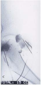 Figure C. Figure C.