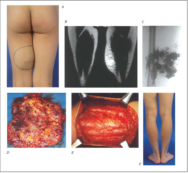 Figure 2 Figure 2