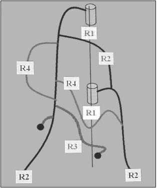 Figure 1 Figure 1