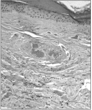 Figure 1 Figure 1