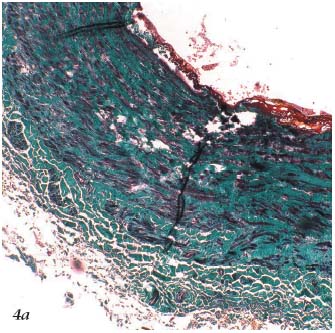 Figure 4a Figure 4a