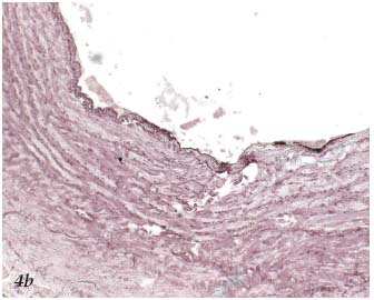 Figure 4b Figure 4b