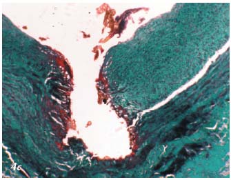 Figure 4c Figure 4c