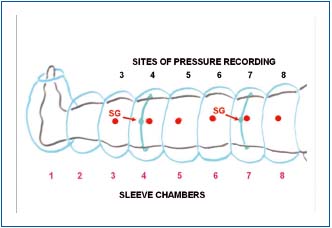 Figure 1 Figure 1