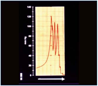 Figure 3 Figure 3