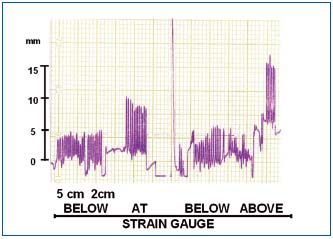 Figure 4 Figure 4