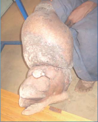 Figure 2b Figure 2b
