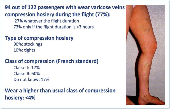 Figure 3. Knowledge of passengers with varicose veins of the benefits of medical compression. Report from 122 passengers with varicose veins.