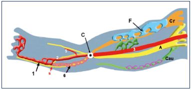 Figure 5. Growth of the three angio-guiding nerves at week 6. Abbreviations: 1, primitive marginal vein; 2, primitive fibular vein; 3, primitive axial vein; 5, primitive anterior tibial vein; 6, intergemellar vein (vein of the sural nerve); A, axial (sciatic); C, popliteal crossroad; Cau, caudal (small sciatic); Cr, cranial (femoral); F, femoral plexus; purple, caudalplexus; s, sural nerve.