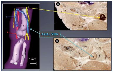 Figure 9. Immune markers for nerves and vessels in a 13-weekold fetus. Panel A. A 3D reconstructed limb showing a big axial vein along the sciatic nerve, while the femoral vein is reduced to a small plexus-shaped network located inside the femoral canal with its companions the femoral artery and femoral nerve. Slices of a 13-week-old fetus stained for nerve-specific immune markers (slice A with protein S-100; Panel B) and vessel-specific immune markers (slice B with D2-40; Panel C) using the CAAD technique. Abbreviations: 1, sciatic nerve; 2, femoral nerve; 3, femoral vein; 4, femoral artery; a, axial vein; CADD, computer-assisted anatomical dissection; f, fibula; F, femur; T, tibia.