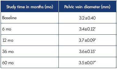 Table III. Results of tranvaginal USAS in 57 patients with pelvic dilation in isolated P V V using the diameter of the pelvic vein. *P=NS compared with baseline. Abbreviations: P V V, pelvic varicose veins; USAS, ultrasound angioscan.