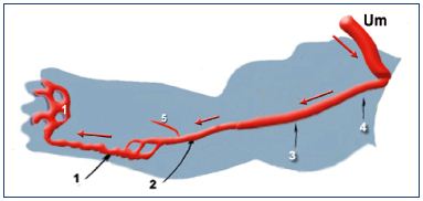 Figure 4. The primitive veins at week 5. Note that the veins of the primitive limb are fed by the umbilical vein (containing oxygenated blood): the blood flux goes from the root to the extremity of the limb (black arrows). Therefore, the veins appear first. The arteries then drain the blood back from the limb (red arrows). Abbreviations: 1, primitive marginal vein; 2, primitive fibular vein; 3, primitive axial vein; 4, primitive ischiatic vein; 5, primitive anterior tibial vein; Um, umbilical vein.