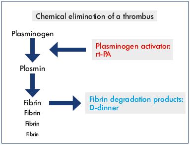 Figure 1. Degradation of the fibrin component of a thrombus to eliminate the thrombus.