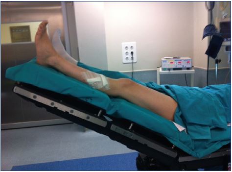 Keep patients supine for 10 minutes after injection and avoid having the patient sit or stand up immediately after the procedure